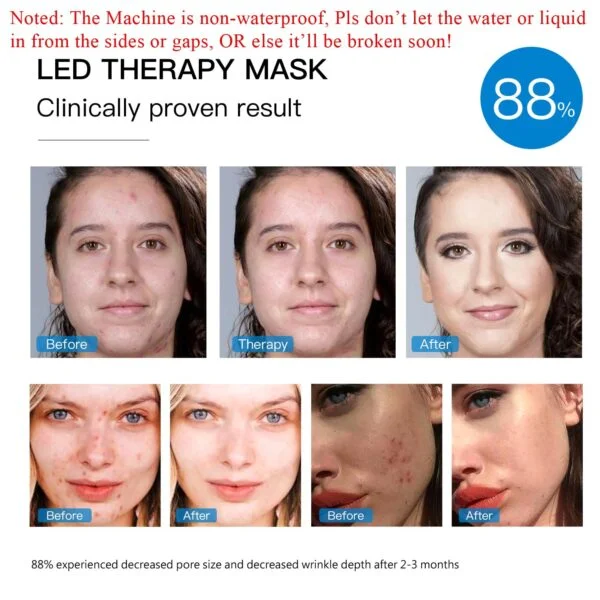 h j i asdfuo j        ——Red Light Therapy Mask for Face, 7+1 Colors LED Facial Skin Care Mask At Home, USB Rechargeable. Portable